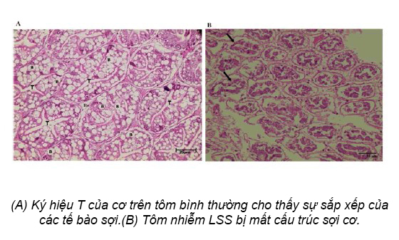Triệu chứng của bệnh lỏng vỏ ở tôm